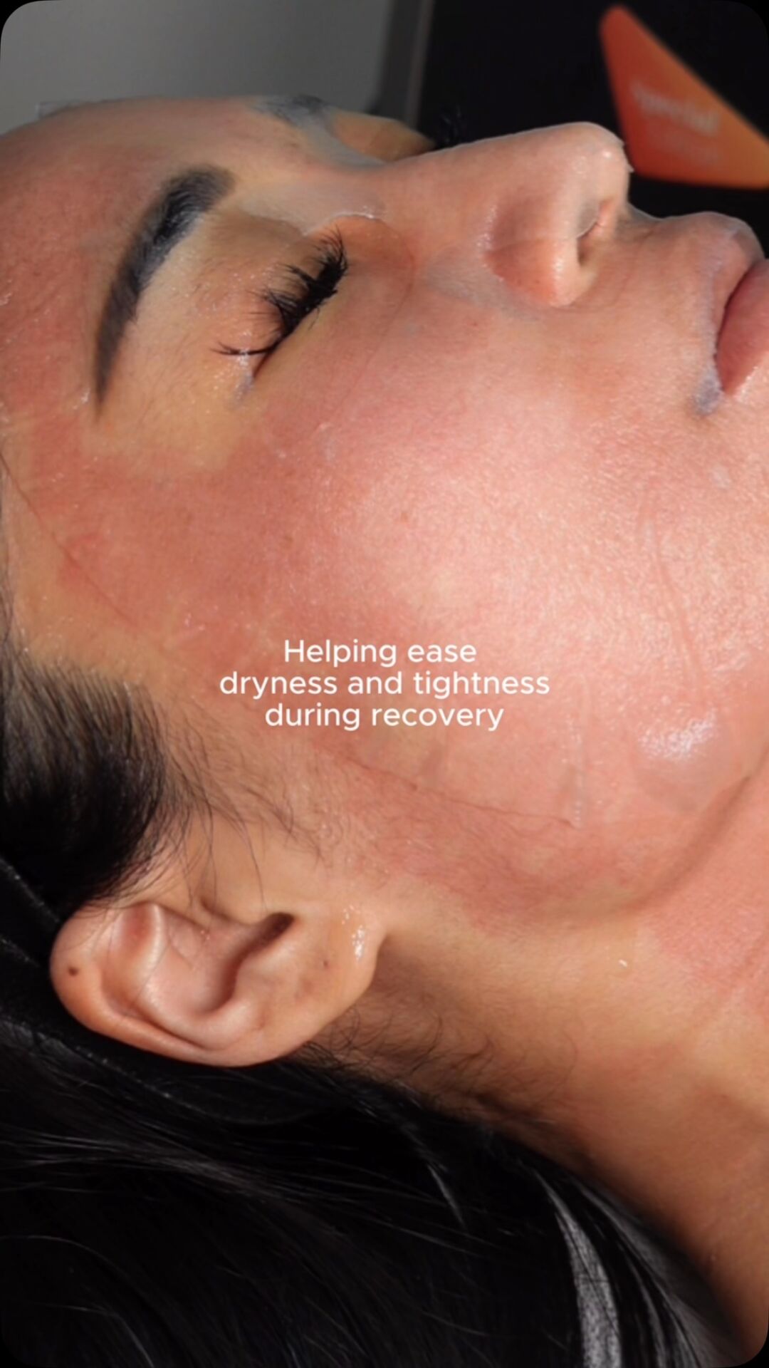 the goal isn’t just smoother-looking skin, it’s supporting your skin throughout the process.